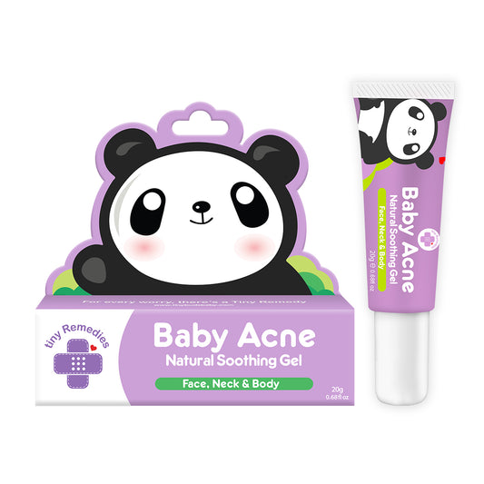 Tiny Buds - Baby Acne Natural Soothing Gel (6559260704802)